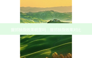 腿部抽脂效果明显吗，腿部抽脂效果对比