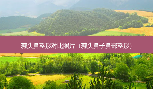 蒜头鼻整形对比照片(蒜头鼻子鼻部整形)-第1张图片-美选资讯网 蒜头鼻整形对比照片(蒜头鼻子鼻部整形)-第1张图片-美选资讯网