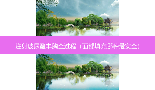 注射玻尿酸丰胸全过程(面部填充哪种 *** )-第1张图片-美选资讯网 注射玻尿酸丰胸全过程(面部填充哪种 *** )-第1张图片-美选资讯网