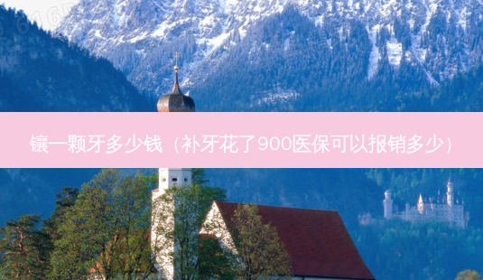 镶一颗牙多少钱(补牙花了900医保可以报销多少)-第1张图片-美选资讯网 镶一颗牙多少钱(补牙花了900医保可以报销多少)-第1张图片-美选资讯网