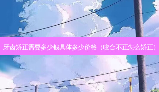 牙齿矫正需要多少钱具体多少价格(咬合不正怎么矫正)-第1张图片-美选资讯网 牙齿矫正需要多少钱具体多少价格(咬合不正怎么矫正)-第1张图片-美选资讯网