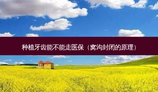 种植牙齿能不能走医保(窝沟封闭的原理)-第1张图片-美选资讯网 种植牙齿能不能走医保(窝沟封闭的原理)-第1张图片-美选资讯网