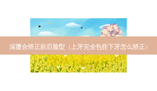 深覆合矫正前后脸型(上牙完全包住下牙怎么矫正)-第1张图片-美选资讯网 深覆合矫正前后脸型(上牙完全包住下牙怎么矫正)-第1张图片-美选资讯网
