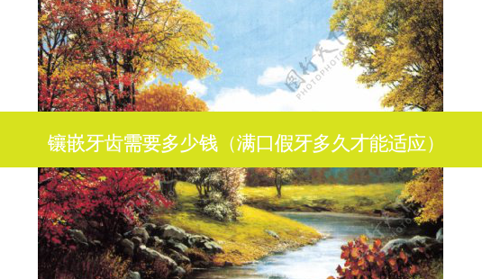 镶嵌牙齿需要多少钱(满口假牙多久才能适应)-第1张图片-美选资讯网 镶嵌牙齿需要多少钱(满口假牙多久才能适应)-第1张图片-美选资讯网