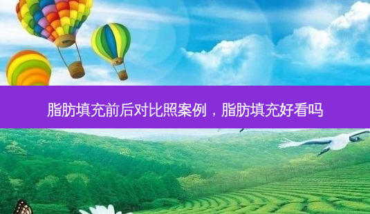 脂肪填充前后对比照案例，脂肪填充好看吗-第1张图片-美选资讯网