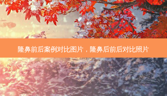 隆鼻前后案例对比图片,隆鼻后前后对比照片-第1张图片-美选资讯网 隆鼻前后案例对比图片,隆鼻后前后对比照片-第1张图片-美选资讯网