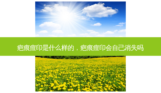 疤痕痘印是什么样的,疤痕痘印会自己消失吗-第1张图片-美选资讯网 疤痕痘印是什么样的,疤痕痘印会自己消失吗-第1张图片-美选资讯网