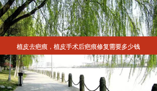 植皮去疤痕,植皮手术后疤痕修复需要多少钱-第1张图片-美选资讯网 植皮去疤痕,植皮手术后疤痕修复需要多少钱-第1张图片-美选资讯网