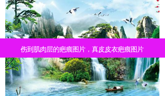 伤到肌肉层的疤痕图片,真皮皮衣疤痕图片-第1张图片-美选资讯网 伤到肌肉层的疤痕图片,真皮皮衣疤痕图片-第1张图片-美选资讯网