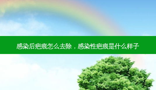 感染后疤痕怎么去除,感染性疤痕是什么样子-第1张图片-美选资讯网 感染后疤痕怎么去除,感染性疤痕是什么样子-第1张图片-美选资讯网