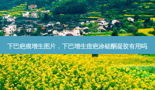 下巴疤痕增生图片,下巴增生痘疤涂硅酮凝胶有用吗-第1张图片-美选资讯网 下巴疤痕增生图片,下巴增生痘疤涂硅酮凝胶有用吗-第1张图片-美选资讯网