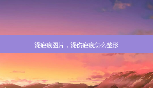 烫疤痕图片,烫伤疤痕怎么整形-第1张图片-美选资讯网 烫疤痕图片,烫伤疤痕怎么整形-第1张图片-美选资讯网