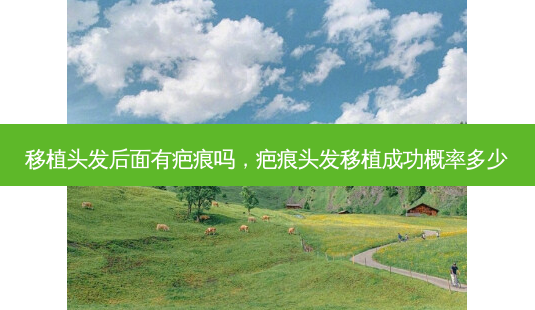 移植头发后面有疤痕吗,疤痕头发移植成功概率多少-第1张图片-美选资讯网 移植头发后面有疤痕吗,疤痕头发移植成功概率多少-第1张图片-美选资讯网