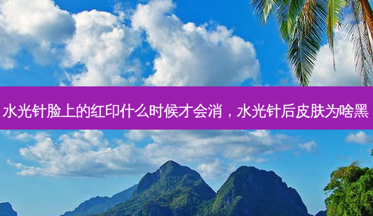 水光针脸上的红印什么时候才会消,水光针后皮肤为啥黑-第1张图片-美选资讯网 水光针脸上的红印什么时候才会消,水光针后皮肤为啥黑-第1张图片-美选资讯网