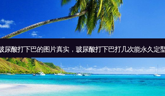 玻尿酸打下巴的图片真实,玻尿酸打下巴打几次能永久定型-第1张图片-美选资讯网 玻尿酸打下巴的图片真实,玻尿酸打下巴打几次能永久定型-第1张图片-美选资讯网