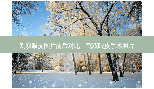 割双眼皮图片前后对比,割双眼皮手术照片-第1张图片-美选资讯网 割双眼皮图片前后对比,割双眼皮手术照片-第1张图片-美选资讯网
