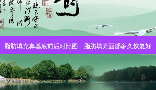 脂肪填充鼻基底前后对比图,脂肪填充面部多久恢复好-第1张图片-美选资讯网 脂肪填充鼻基底前后对比图,脂肪填充面部多久恢复好-第1张图片-美选资讯网