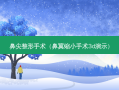 鼻尖整形手术（鼻翼缩小手术3d演示）