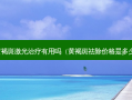 黄褐斑激光有用吗（黄褐斑祛除价格是多少）