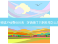 牙科拔牙收费价目表（牙齿断了只剩根部怎么办）