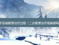 牙齿做根管过程（二次根管很麻烦吗）