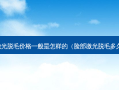 脸上激光脱毛价格一般是怎样的（脸部激光脱毛多久有效）