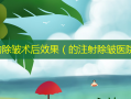 生物除皱术后效果（的注射除皱医院）