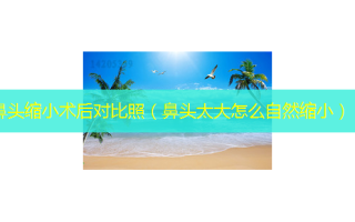 鼻头缩小术后对比照（鼻头太大怎么自然缩小）