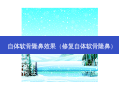 自体软骨隆鼻效果（修复自体软骨隆鼻）