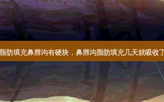 脂肪填充鼻唇沟有硬块，鼻唇沟脂肪填充几天就吸收了