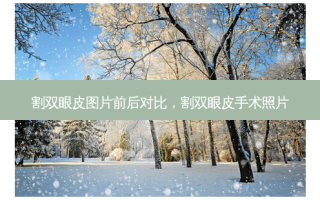 割双眼皮图片前后对比，割双眼皮手术照片