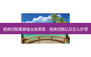 疤痕切除重新缝合效果图，疤痕切除以后怎么护理