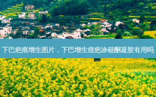 下巴疤痕增生图片，下巴增生痘疤涂硅酮凝胶有用吗