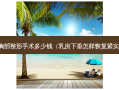 胸部整形手术多少钱（ *** 下垂怎样恢复紧实）