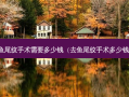 鱼尾纹手术需要多少钱（去鱼尾纹手术多少钱）