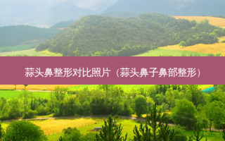 蒜头鼻整形对比照片（蒜头鼻子鼻部整形）