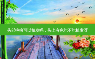 头部疤痕可以植发吗，头上有疤能不能植发呀