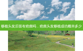 移植头发后面有疤痕吗，疤痕头发移植成功概率多少