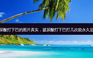 玻尿酸打下巴的图片真实，玻尿酸打下巴打几次能永久定型