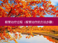根管过程（根管的 *** 步骤）