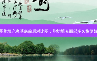 脂肪填充鼻基底前后对比图，脂肪填充面部多久恢复好