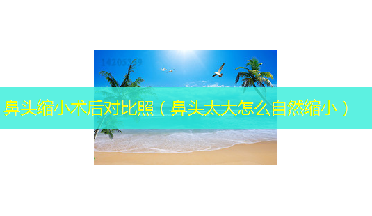 鼻头缩小术后对比照(鼻头太大怎么自然缩小)-第1张图片-美选资讯网 鼻头缩小术后对比照(鼻头太大怎么自然缩小)-第1张图片-美选资讯网